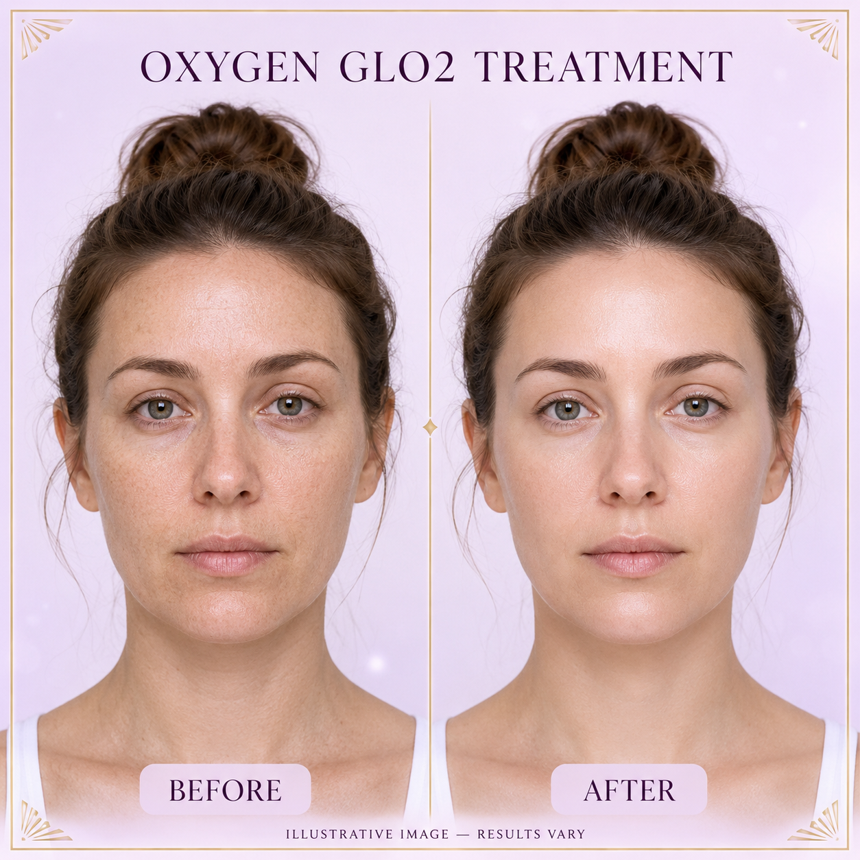 OxyGlow 2